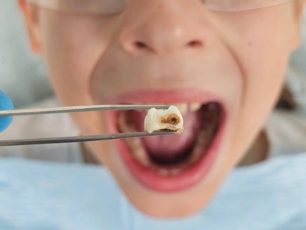  Georgetown, CT Emergency Dentist Pros