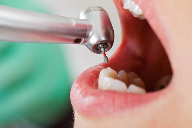 Best Emergency Treatment for Toothache in Georgetown, CT